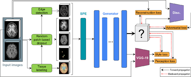 Figure 3 for Self-Supervised CSF Inpainting with Synthetic Atrophy for Improved Accuracy Validation of Cortical Surface Analyses