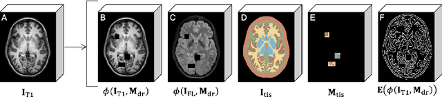 Figure 4 for Self-Supervised CSF Inpainting with Synthetic Atrophy for Improved Accuracy Validation of Cortical Surface Analyses