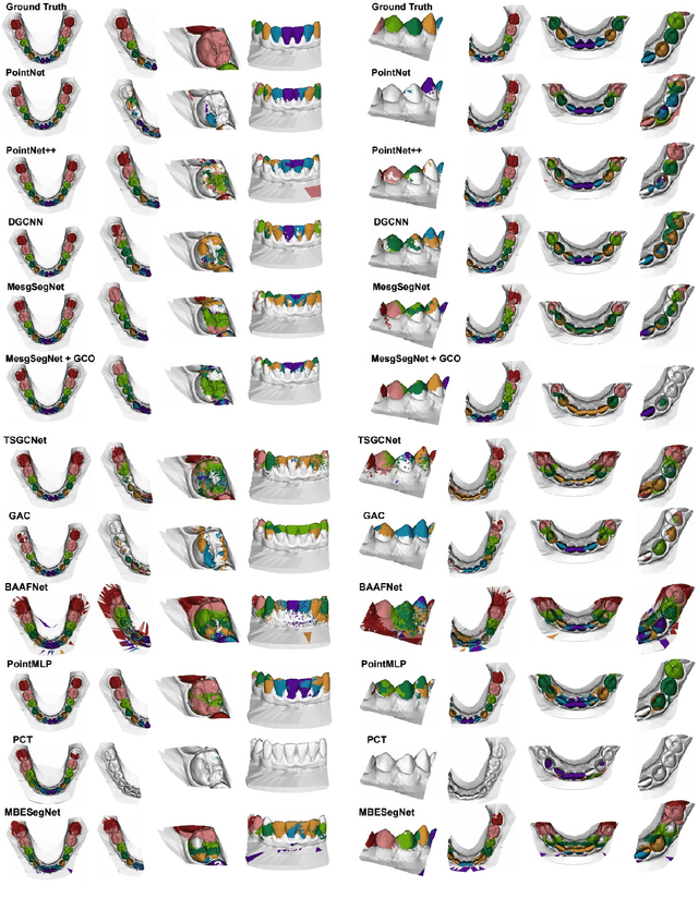 Figure 2 for A Critical Analysis of the Limitation of Deep Learning based 3D Dental Mesh Segmentation Methods in Segmenting Partial Scans