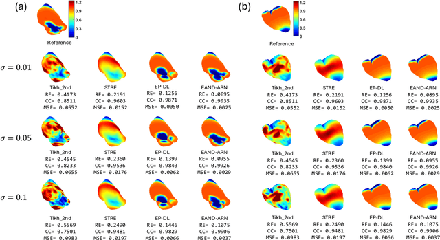 Figure 2 for Numerical Differentiation-based Electrophysiology-Aware Adaptive ResNet for Inverse ECG Modeling