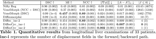 Figure 2 for Registration of Longitudinal Liver Examinations for Tumor Progress Assessment