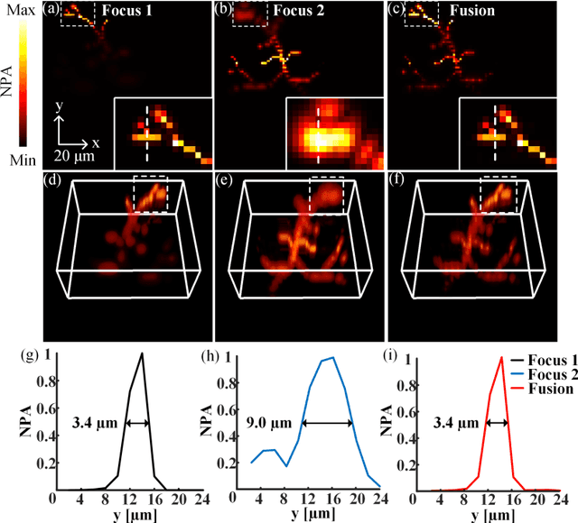 Figure 3 for Direct 3D information fusion for depth of field enhancement in optical-resolution photoacoustic microscopy