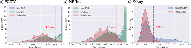 Figure 2 for Unconditional Latent Diffusion Models Memorize Patient Imaging Data