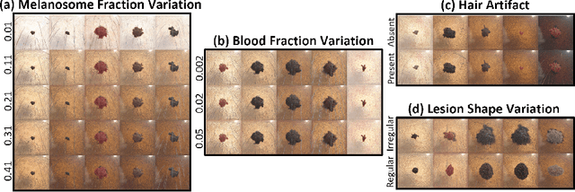 Figure 3 for S-SYNTH: Knowledge-Based, Synthetic Generation of Skin Images