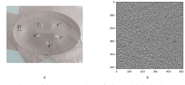 Figure 1 for Low contrast detection and super-resolution in CT images: evaluation of a novel approach based on Centroidal Voronoi Tessellation