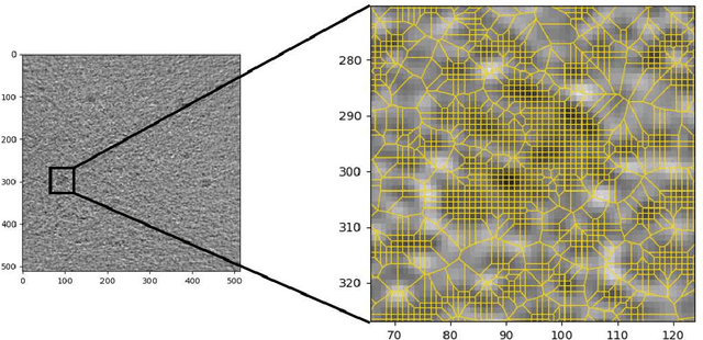 Figure 2 for Low contrast detection and super-resolution in CT images: evaluation of a novel approach based on Centroidal Voronoi Tessellation