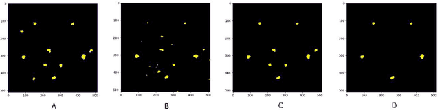 Figure 3 for Low contrast detection and super-resolution in CT images: evaluation of a novel approach based on Centroidal Voronoi Tessellation