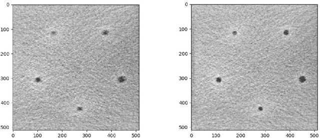 Figure 4 for Low contrast detection and super-resolution in CT images: evaluation of a novel approach based on Centroidal Voronoi Tessellation