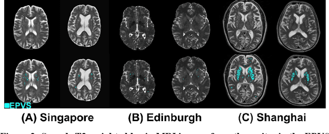 Figure 3 for Standardized Evaluation of Automatic Methods for Perivascular Spaces Segmentation in MRI -- MICCAI 2024 Challenge Results