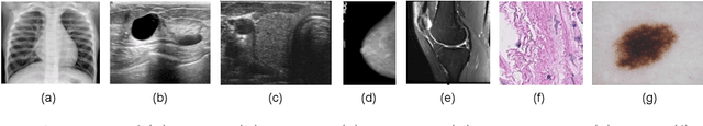 Figure 3 for Revisiting Hidden Representations in Transfer Learning for Medical Imaging