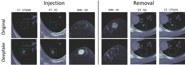 Figure 3 for Back-in-Time Diffusion: Unsupervised Detection of Medical Deepfakes