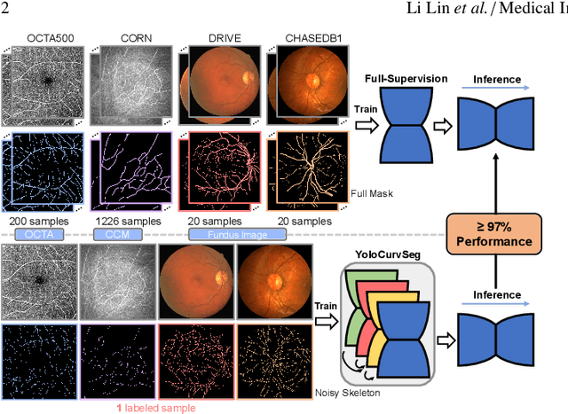 Figure 1 for YoloCurvSeg: You Only Label One Noisy Skeleton for Vessel-style Curvilinear Structure Segmentation