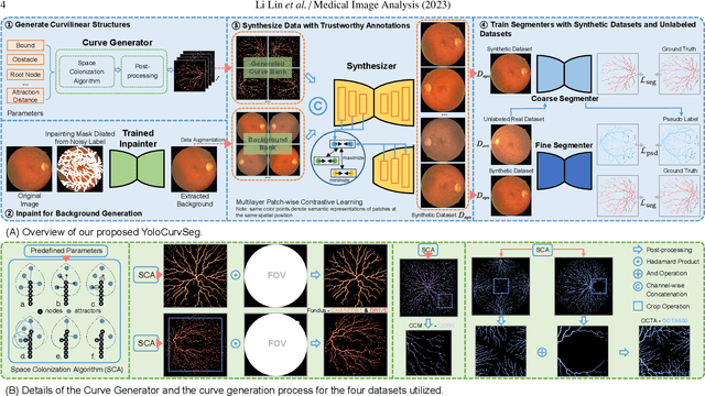 Figure 3 for YoloCurvSeg: You Only Label One Noisy Skeleton for Vessel-style Curvilinear Structure Segmentation