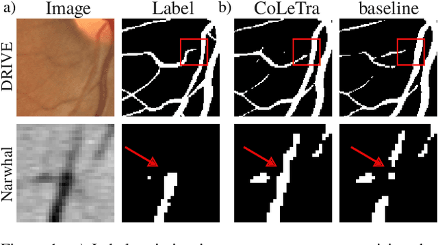 Figure 1 for Disconnect to Connect: A Data Augmentation Method for Improving Topology Accuracy in Image Segmentation