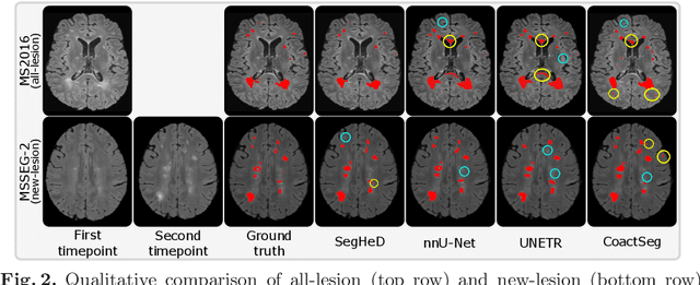 Figure 4 for SegHeD: Segmentation of Heterogeneous Data for Multiple Sclerosis Lesions with Anatomical Constraints