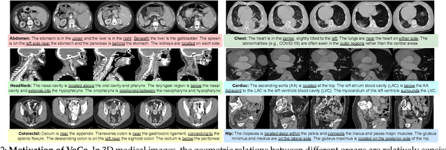 Figure 3 for Large-Scale 3D Medical Image Pre-training with Geometric Context Priors