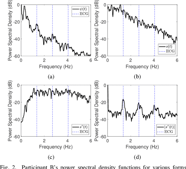 Figure 2 for Accurate Radar-Based Heartbeat Measurement Using Higher Harmonic Components
