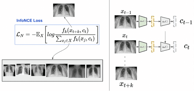 Figure 2 for The Effect of Negation on CLIP in Medical Imaging: Limitations of Contrastive Language-Image Pretraining