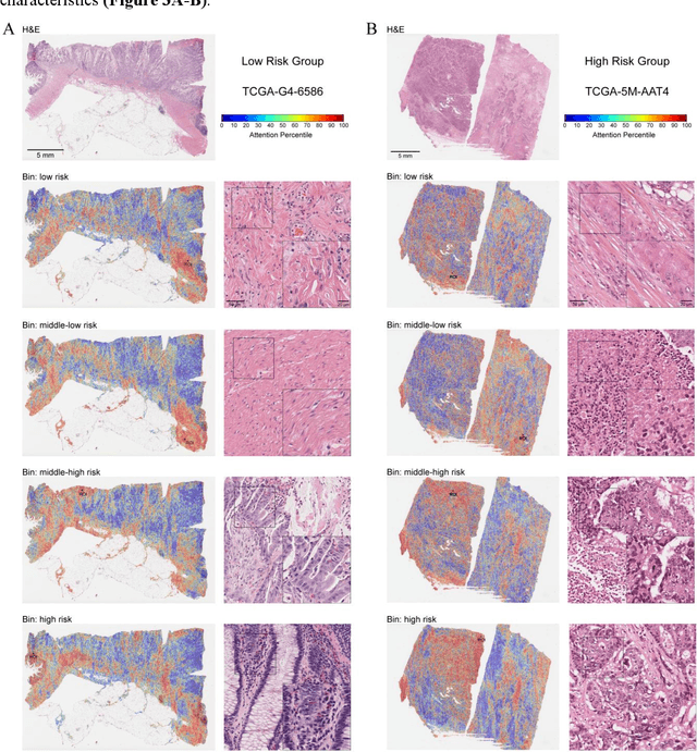 Figure 4 for Deep Pathomic Learning Defines Prognostic Subtypes and Molecular Drivers in Colorectal Cancer