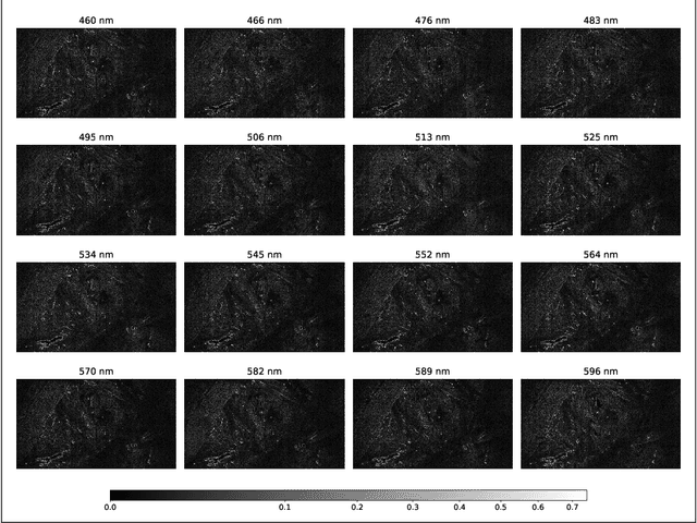 Figure 4 for A self-supervised and adversarial approach to hyperspectral demosaicking and RGB reconstruction in surgical imaging