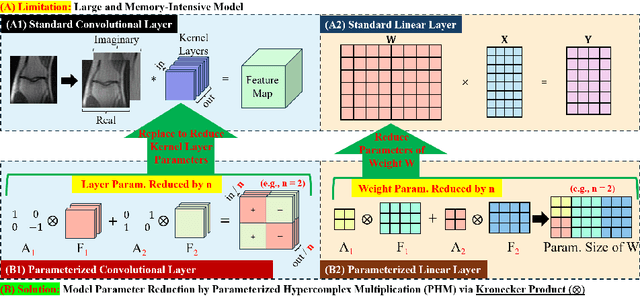 Figure 1 for Lightweight Hypercomplex MRI Reconstruction: A Generalized Kronecker-Parameterized Approach