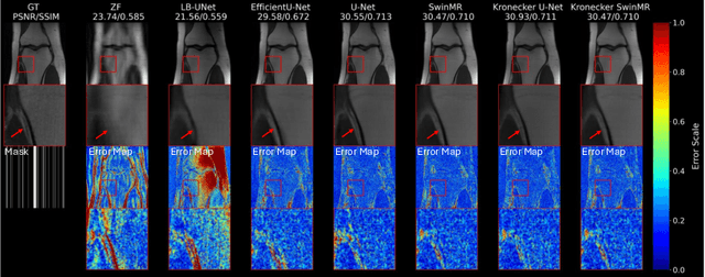 Figure 3 for Lightweight Hypercomplex MRI Reconstruction: A Generalized Kronecker-Parameterized Approach