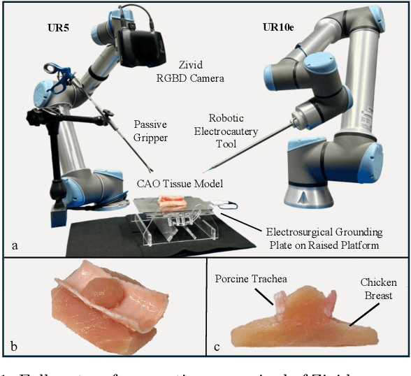 Figure 1 for Autonomous Vision-Guided Resection of Central Airway Obstruction