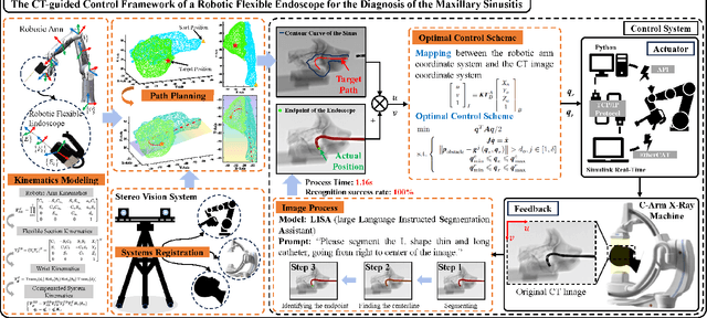 Figure 3 for A CT-guided Control Framework of a Robotic Flexible Endoscope for the Diagnosis of the Maxillary Sinusitis