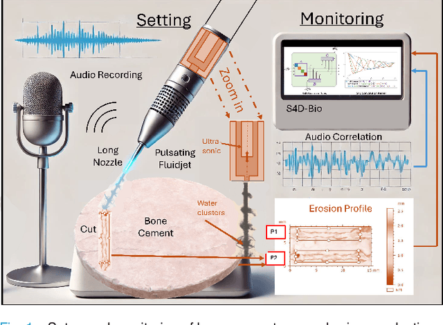 Figure 1 for S4D-Bio Audio Monitoring of Bone Cement Disintegration in Pulsating Fluid Jet Surgery under Laboratory Conditions