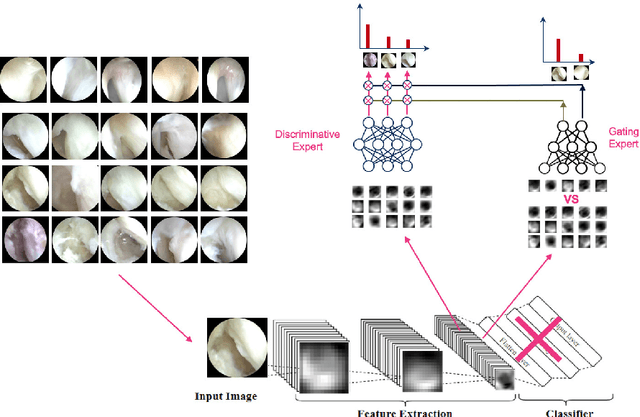Figure 1 for Modular Neural Network Approaches for Surgical Image Recognition
