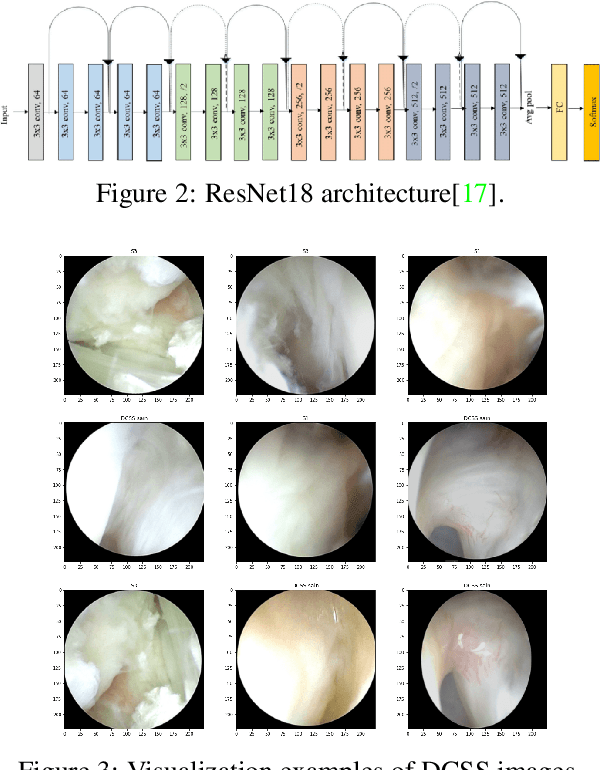 Figure 3 for Modular Neural Network Approaches for Surgical Image Recognition