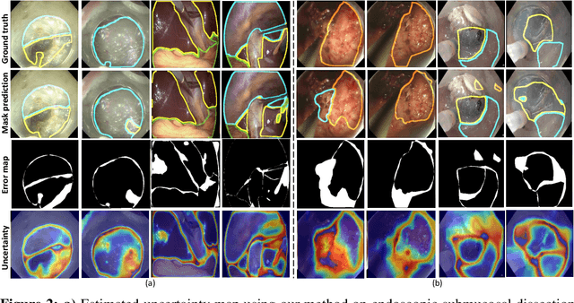 Figure 4 for Uncertainty Estimation for Safety-critical Scene Segmentation via Fine-grained Reward Maximization