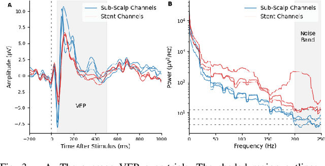 Figure 3 for Comparison of Sub-Scalp EEG and Endovascular Stent-Electrode Array for Visual Evoked Potential Brain-Computer Interface