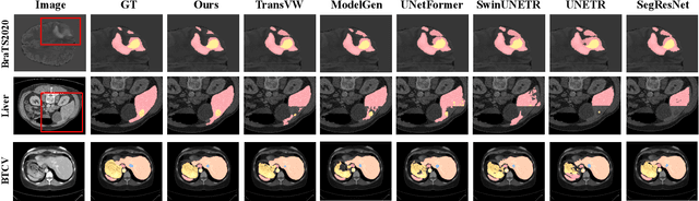 Figure 3 for HybridMIM: A Hybrid Masked Image Modeling Framework for 3D Medical Image Segmentation