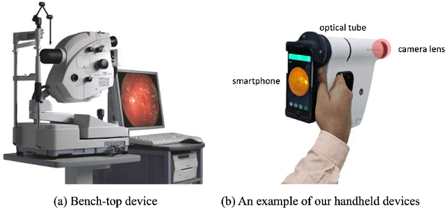 Figure 1 for RVD: A Handheld Device-Based Fundus Video Dataset for Retinal Vessel Segmentation