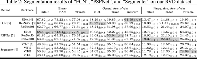 Figure 3 for RVD: A Handheld Device-Based Fundus Video Dataset for Retinal Vessel Segmentation