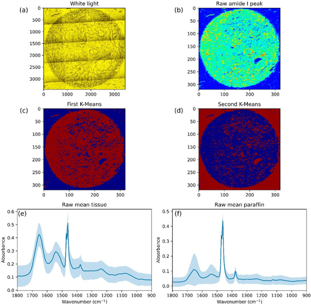 Figure 3 for One-dimensional convolutional neural network model for breast cancer subtypes classification and biochemical content evaluation using micro-FTIR hyperspectral images