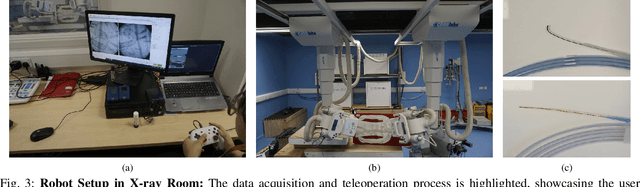 Figure 3 for SplineFormer: An Explainable Transformer-Based Approach for Autonomous Endovascular Navigation
