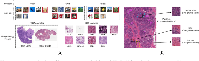 Figure 1 for Enhancing Instance-Level Image Classification with Set-Level Labels