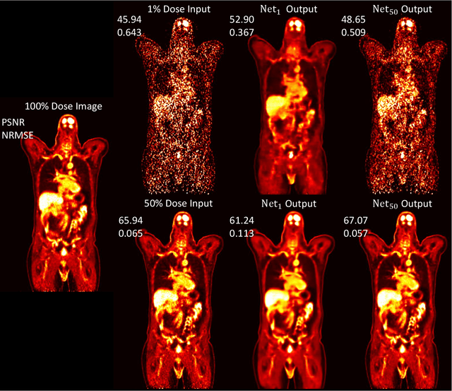 Figure 1 for Unified Noise-aware Network for Low-count PET Denoising