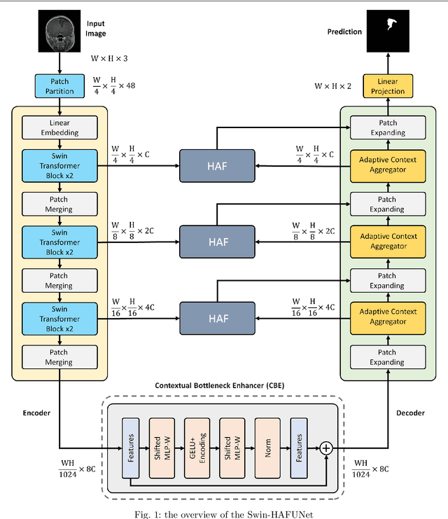 Figure 2 for BRISC: Annotated Dataset for Brain Tumor Segmentation and Classification with Swin-HAFNet