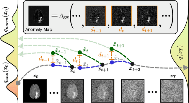 Figure 1 for Unsupervised Anomaly Detection using Aggregated Normative Diffusion