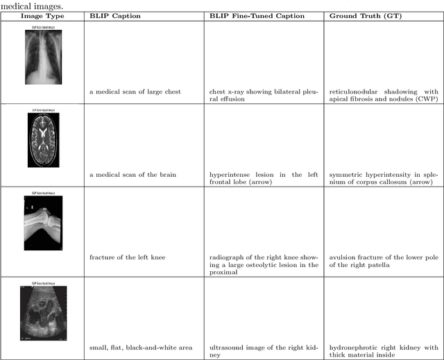 Figure 4 for MedBLIP: Fine-tuning BLIP for Medical Image Captioning