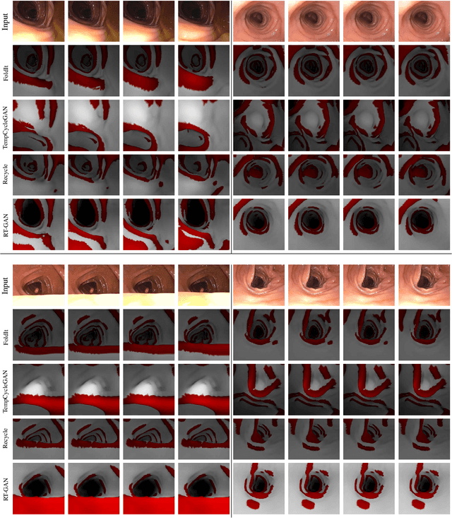 Figure 2 for RT-GAN: Recurrent Temporal GAN for Adding Lightweight Temporal Consistency to Frame-Based Domain Translation Approaches
