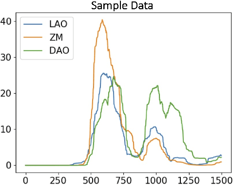Figure 3 for Knowledge Distilled Ensemble Model for sEMG-based Silent Speech Interface