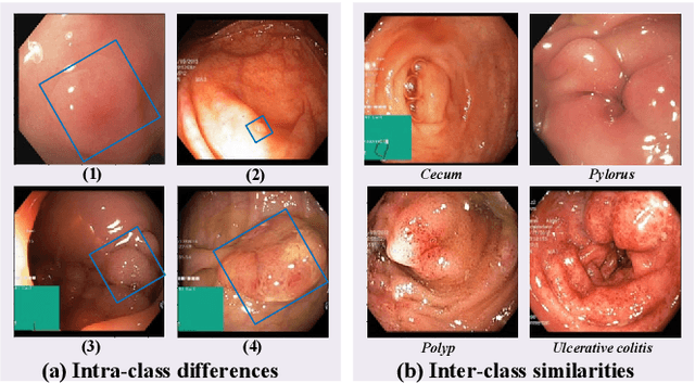 Figure 1 for DFE-IANet: A Method for Polyp Image Classification Based on Dual-domain Feature Extraction and Interaction Attention