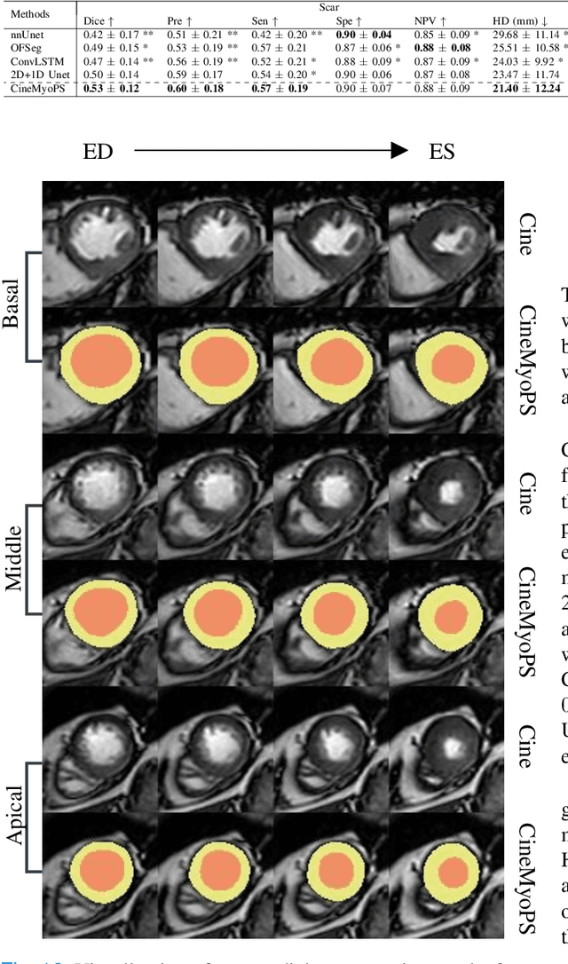 Figure 2 for CineMyoPS: Segmenting Myocardial Pathologies from Cine Cardiac MR