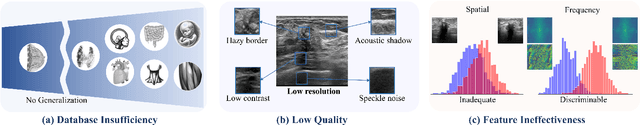 Figure 1 for USFM: A Universal Ultrasound Foundation Model Generalized to Tasks and Organs towards Label Efficient Image Analysis