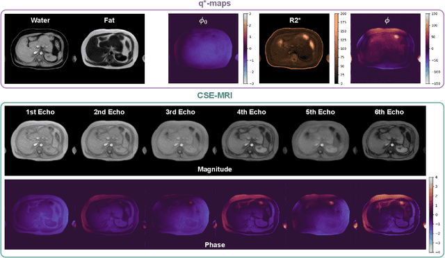 Figure 3 for A Physics-based Generative Model to Synthesize Training Datasets for MRI-based Fat Quantification