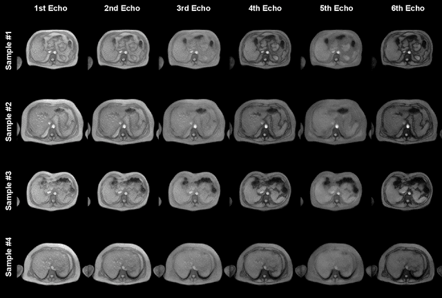 Figure 4 for A Physics-based Generative Model to Synthesize Training Datasets for MRI-based Fat Quantification